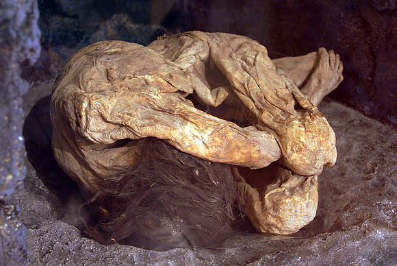 Lemon Grove Mummy